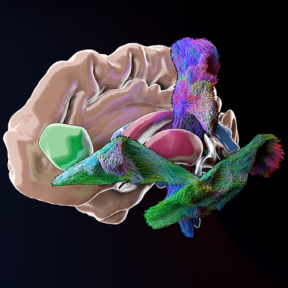 Tractography rendering